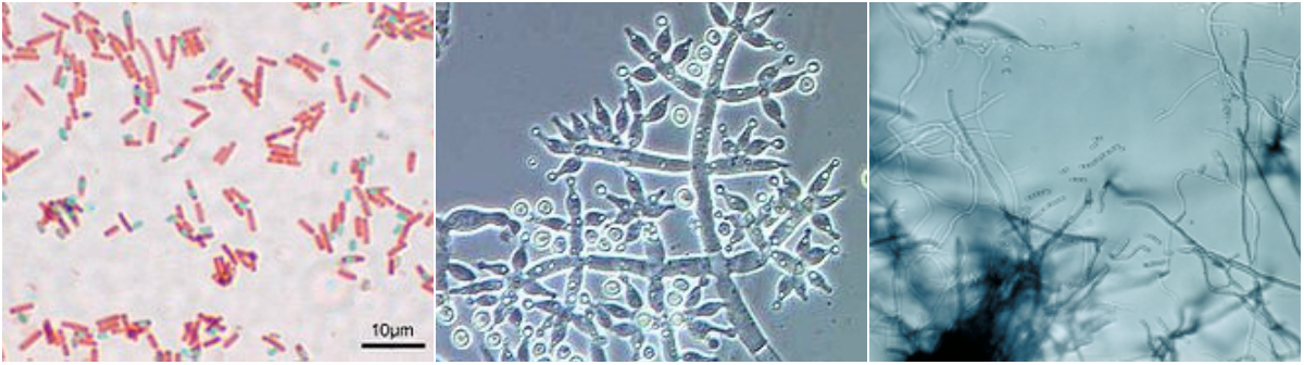 collage-bacillus